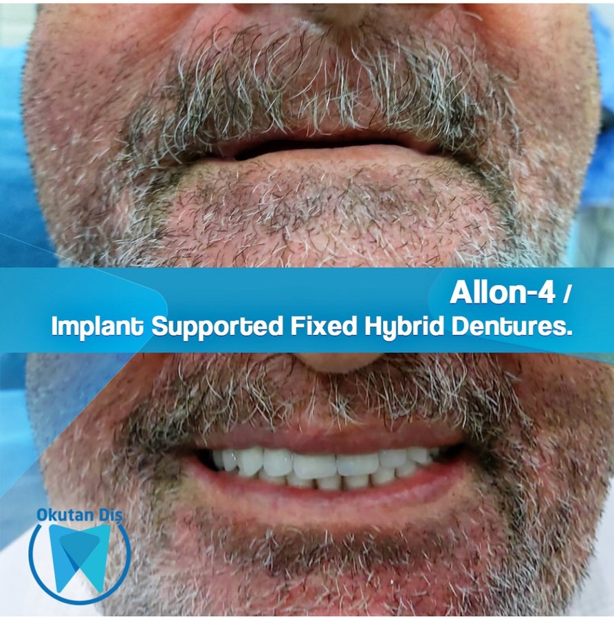 OkutanDis Halkali Dental Clinic - OkutanDis Halkali Dental Clinic