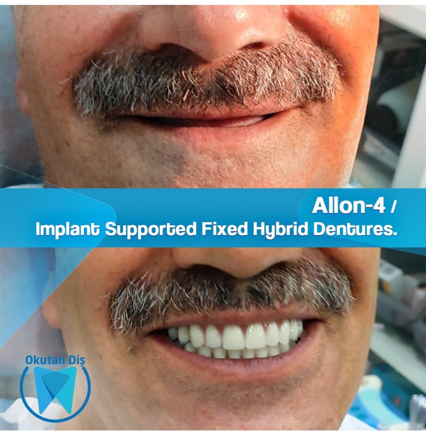 OkutanDis Halkali Dental Clinic - OkutanDis Halkali Dental Clinic