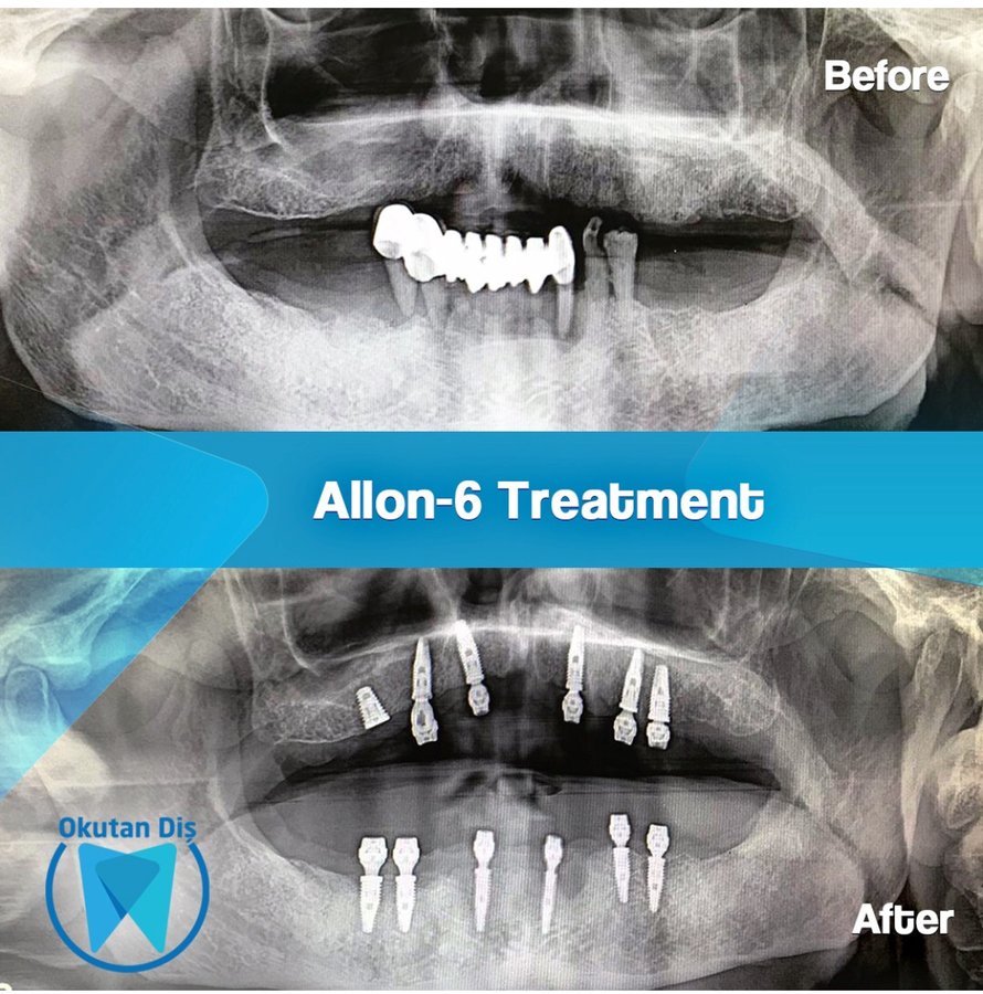 OkutanDis Halkali Dental Clinic - OkutanDis Halkali Dental Clinic