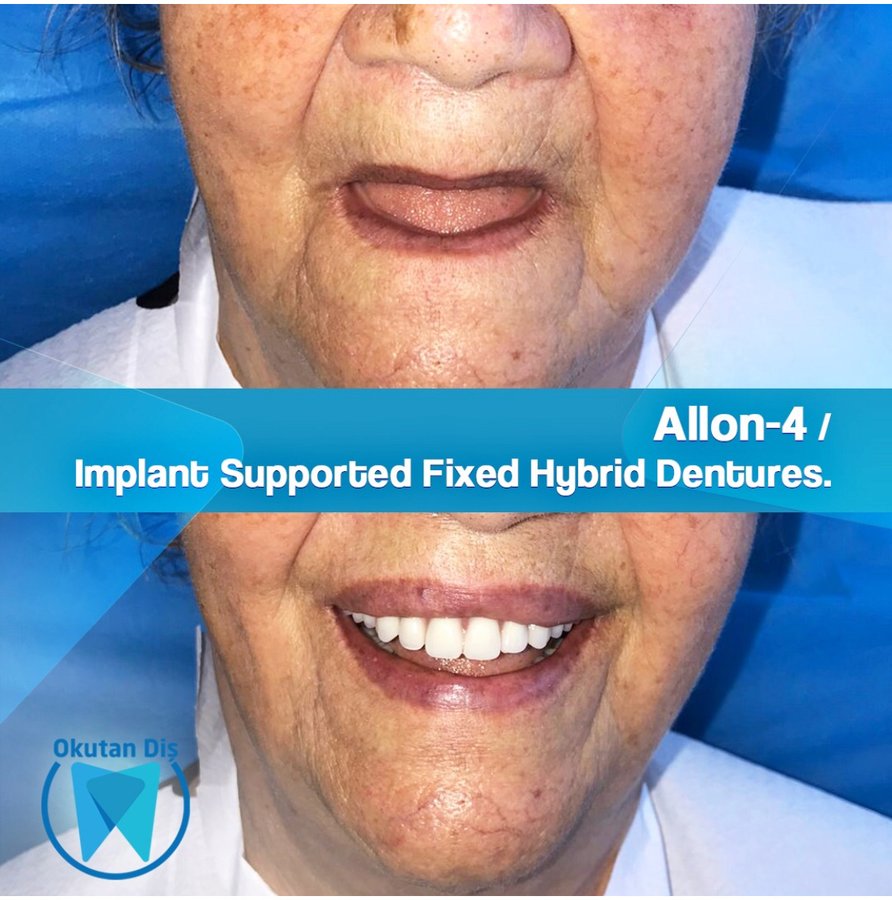 OkutanDis Halkali Dental Clinic - OkutanDis Halkali Dental Clinic