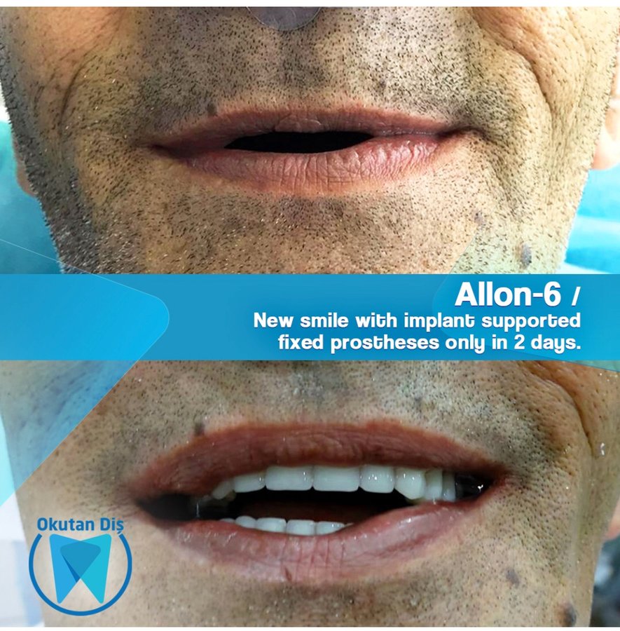 OkutanDis Halkali Dental Clinic - OkutanDis Halkali Dental Clinic