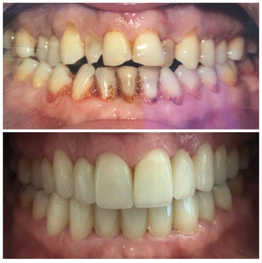 OkutanDis Halkali Dental Clinic - OkutanDis Halkali Dental Clinic