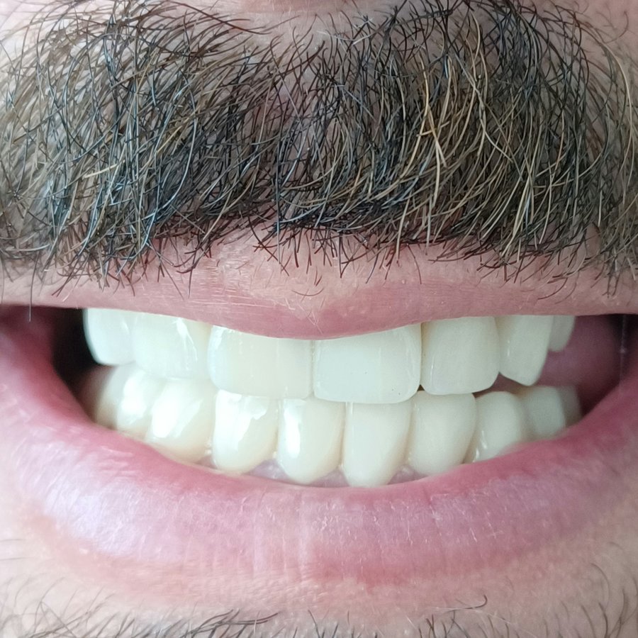 OkutanDis Halkali Dental Clinic - OkutanDis Halkali Dental Clinic