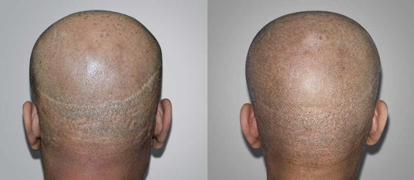 Oliva Skin & Hair Clinic Kadavanthra - Kochi - Oliva Skin & Hair Clinic Kadavanthra - Kochi