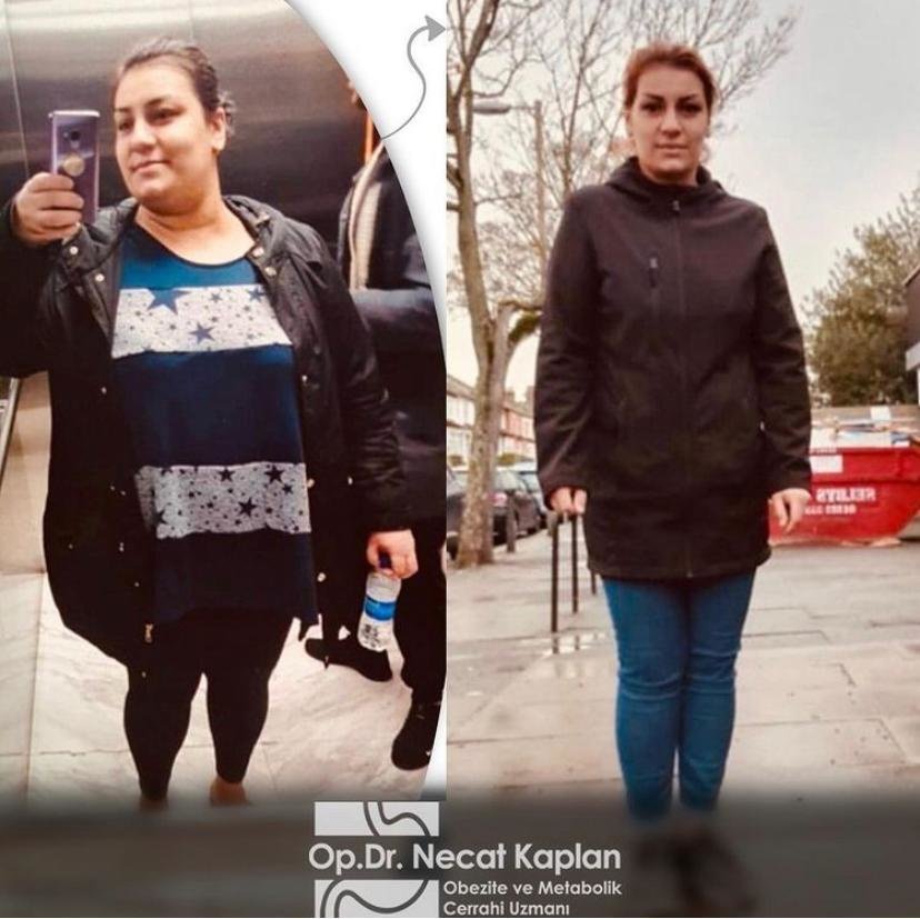 OMC Klinik -Op.Dr.Necat KAPLAN - OMC Klinik -Op.Dr.Necat KAPLAN