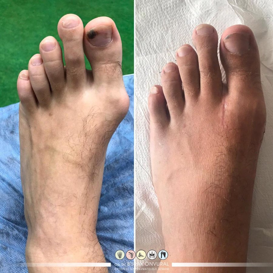 Onv Ortho - Onv Ortho