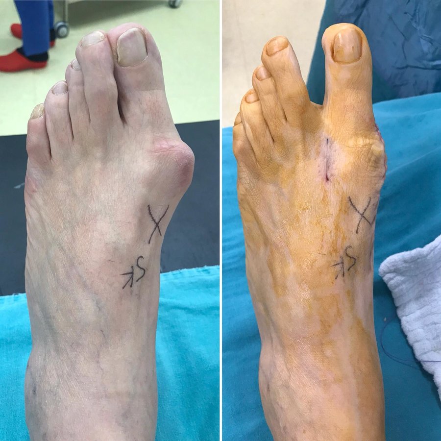 Onv Ortho - Onv Ortho