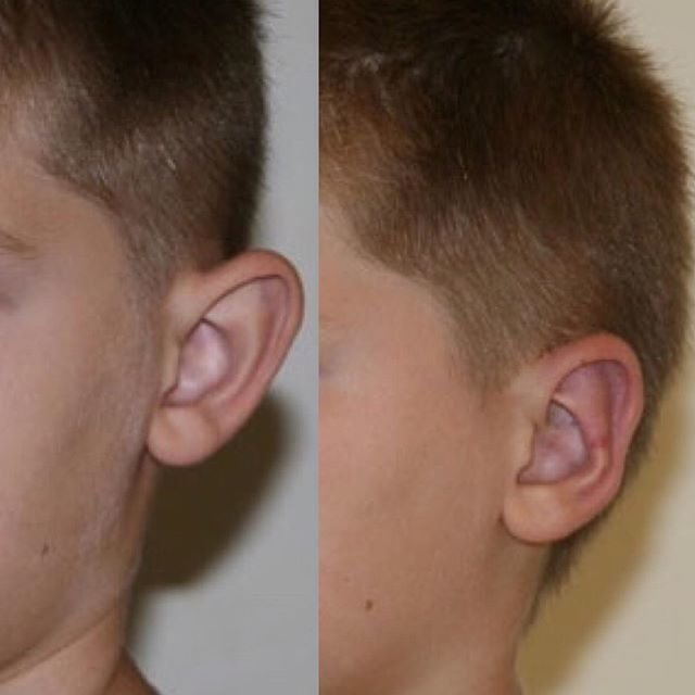 Op. Dr. Erbil KILIÇ - Op. Dr. Erbil KILIÇ