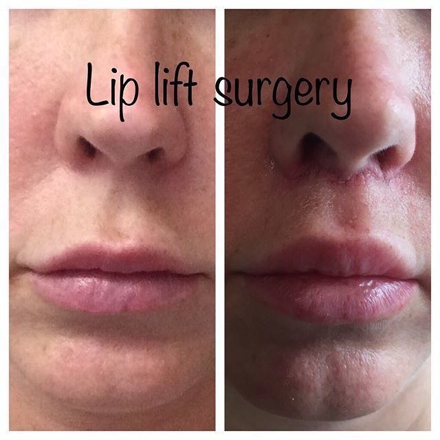 Op. Dr. Erbil KILIÇ - Op. Dr. Erbil KILIÇ