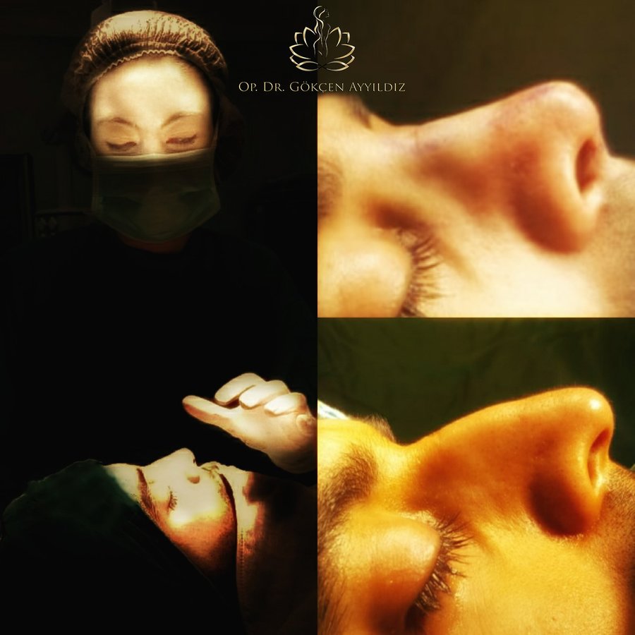 Op. Dr. Gökçen Ayyıldız Estetik Cerrahi Kliniği - Op. Dr. Gökçen Ayyıldız Estetik Cerrahi Kliniği