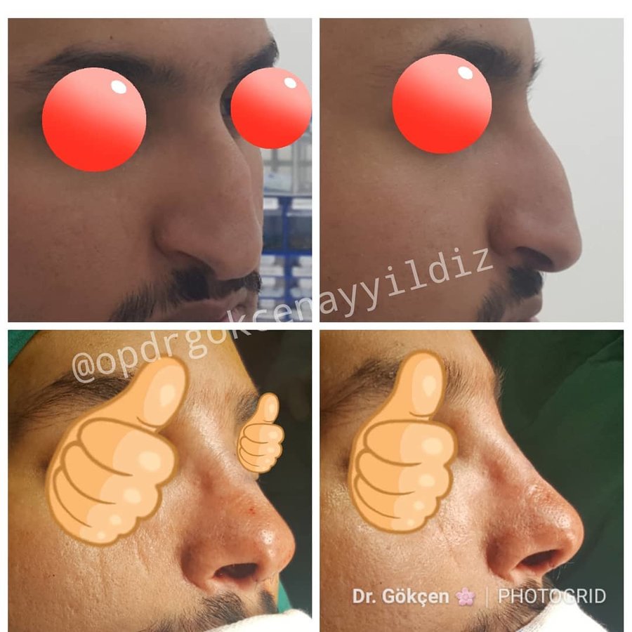 Op. Dr. Gökçen Ayyıldız Estetik Cerrahi Kliniği - Op. Dr. Gökçen Ayyıldız Estetik Cerrahi Kliniği