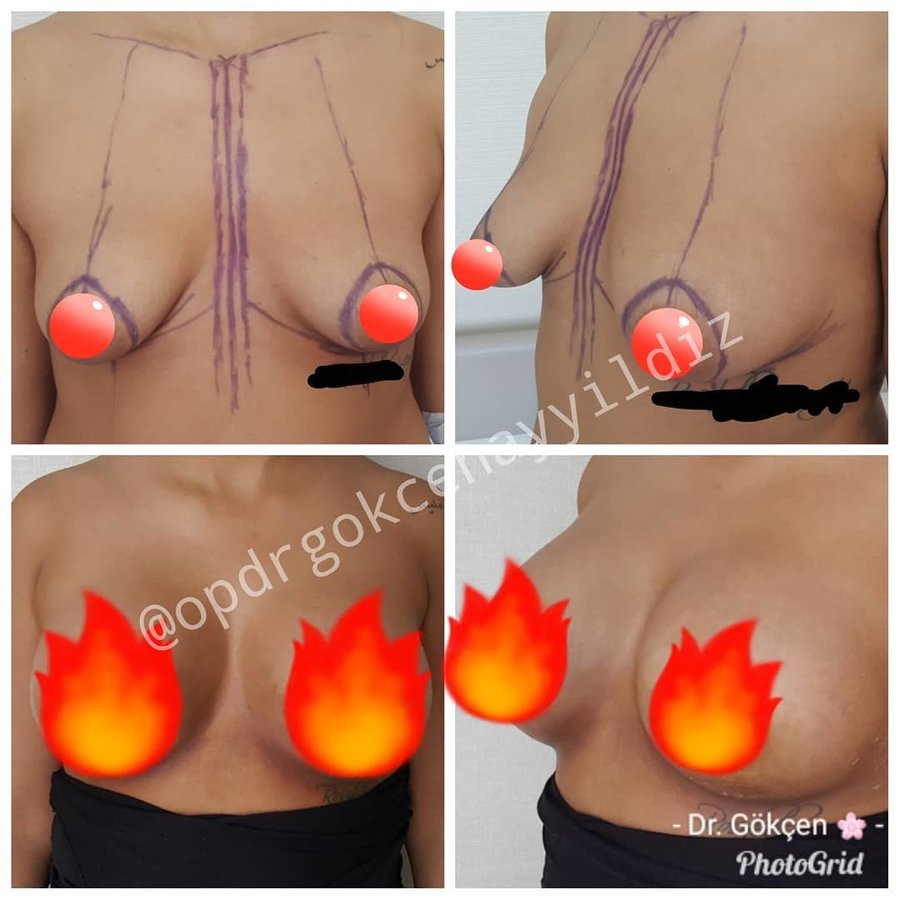 Op. Dr. Gökçen Ayyıldız Estetik Cerrahi Kliniği - Op. Dr. Gökçen Ayyıldız Estetik Cerrahi Kliniği