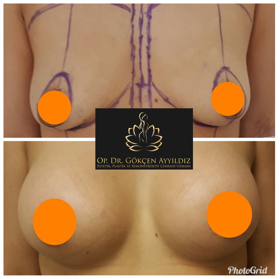 Op. Dr. Gökçen Ayyıldız Estetik Cerrahi Kliniği - Op. Dr. Gökçen Ayyıldız Estetik Cerrahi Kliniği