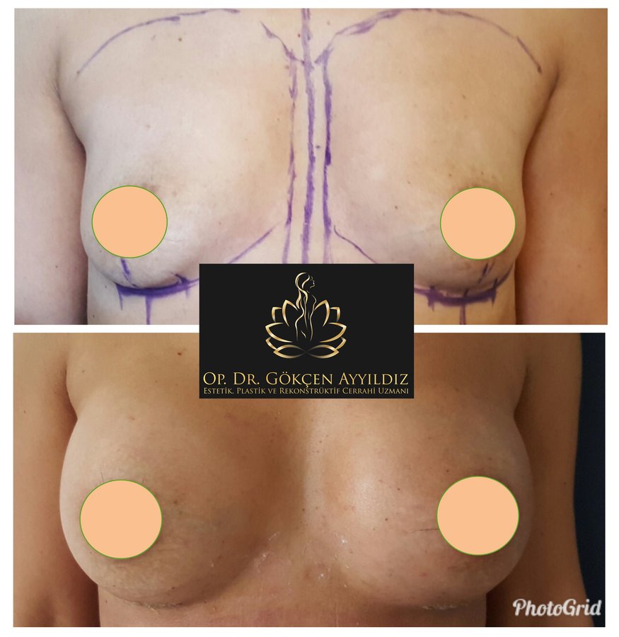 Op. Dr. Gökçen Ayyıldız Estetik Cerrahi Kliniği - Op. Dr. Gökçen Ayyıldız Estetik Cerrahi Kliniği