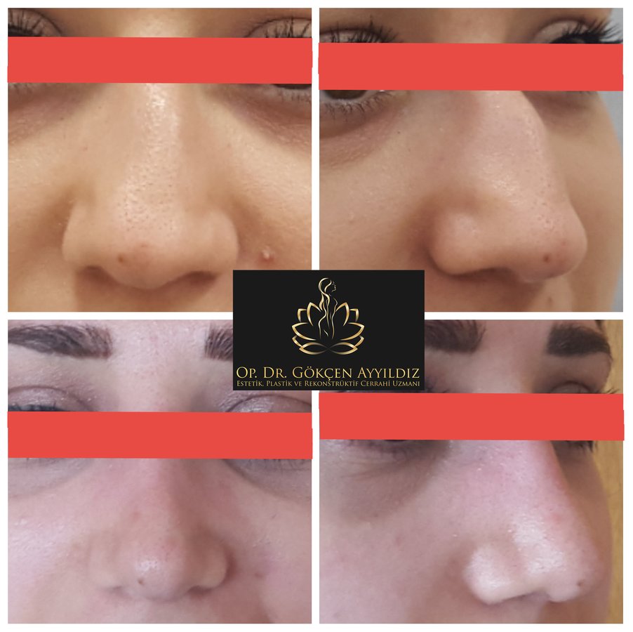 Op. Dr. Gökçen Ayyıldız Estetik Cerrahi Kliniği - Op. Dr. Gökçen Ayyıldız Estetik Cerrahi Kliniği