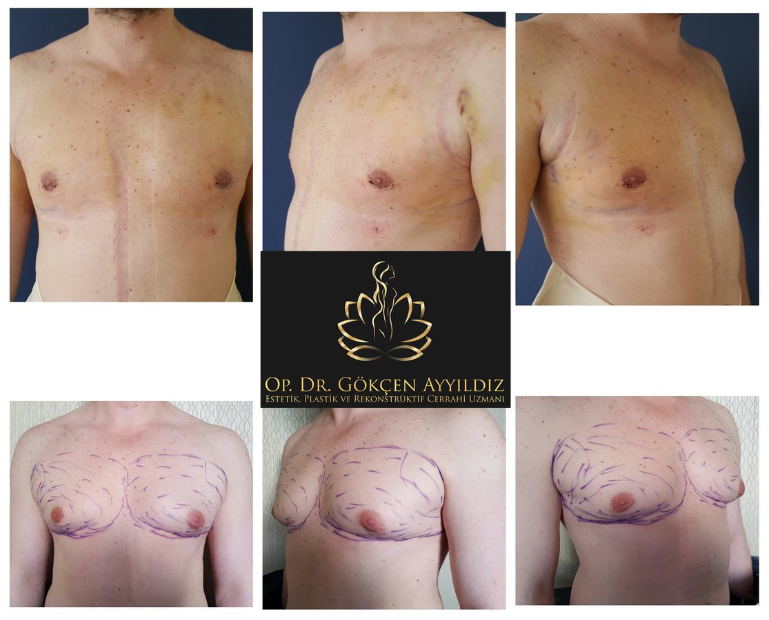 Op. Dr. Gökçen Ayyıldız Estetik Cerrahi Kliniği - Op. Dr. Gökçen Ayyıldız Estetik Cerrahi Kliniği