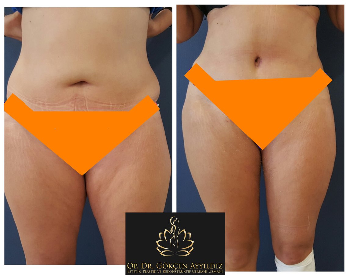 Op. Dr. Gökçen Ayyıldız Estetik Cerrahi Kliniği - Op. Dr. Gökçen Ayyıldız Estetik Cerrahi Kliniği