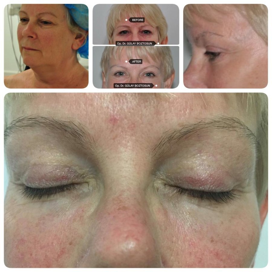 Op. Dr. Gülay Boztosun - Op. Dr. Gülay Boztosun