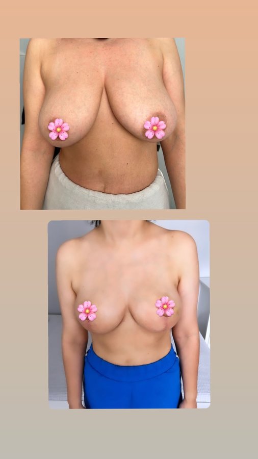 Op. Dr. Gülay Boztosun - Op. Dr. Gülay Boztosun