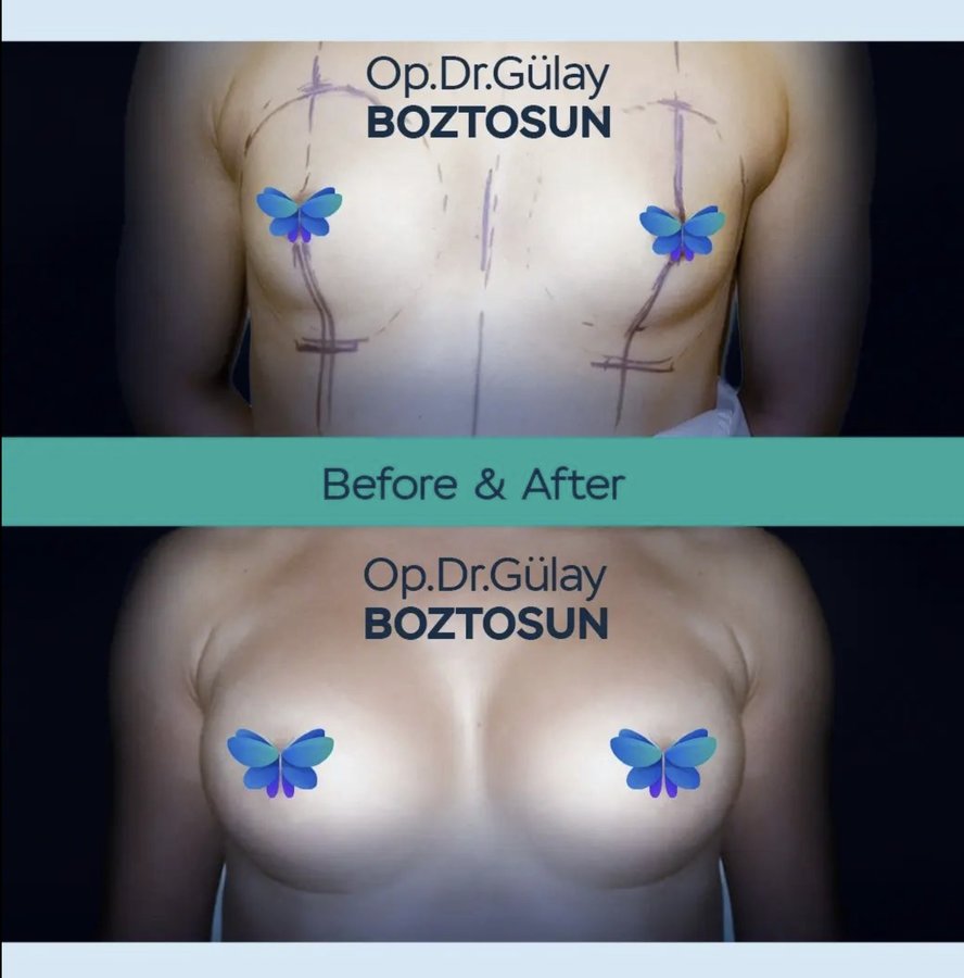 Op. Dr. Gülay Boztosun - Op. Dr. Gülay Boztosun