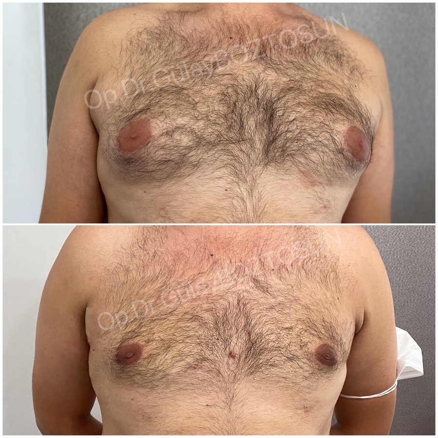 Op. Dr. Gülay Boztosun - Op. Dr. Gülay Boztosun