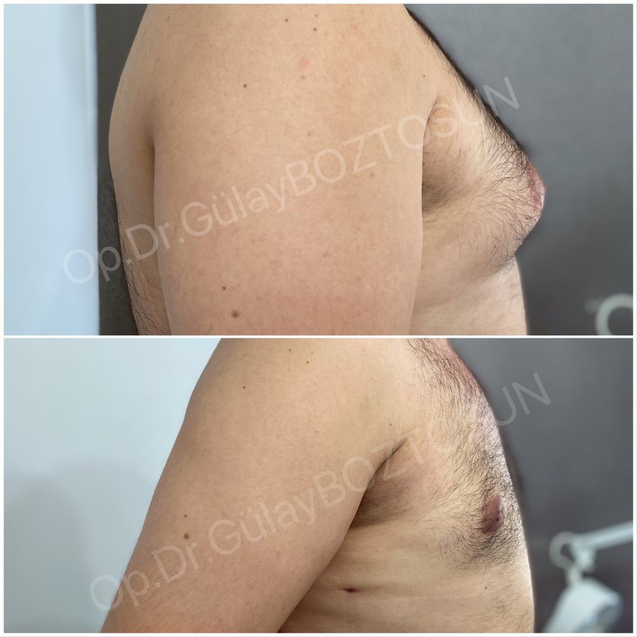 Op. Dr. Gülay Boztosun - Op. Dr. Gülay Boztosun