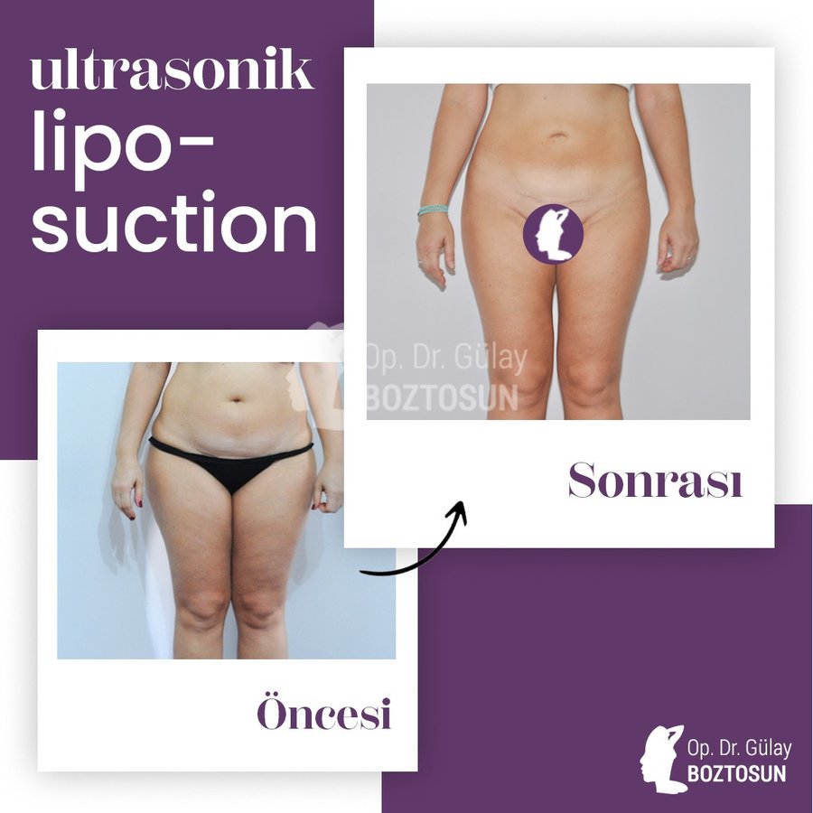 Op. Dr. Gülay Boztosun - Op. Dr. Gülay Boztosun