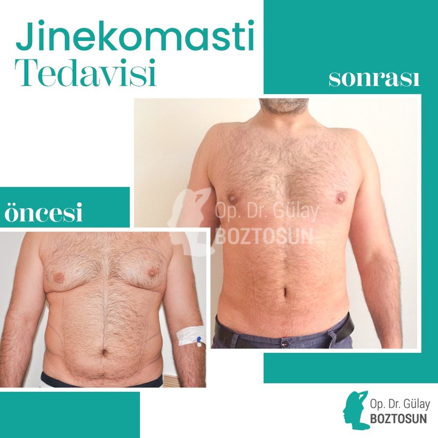 Op. Dr. Gülay Boztosun - Op. Dr. Gülay Boztosun