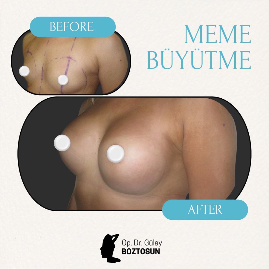 Op. Dr. Gülay Boztosun - Op. Dr. Gülay Boztosun