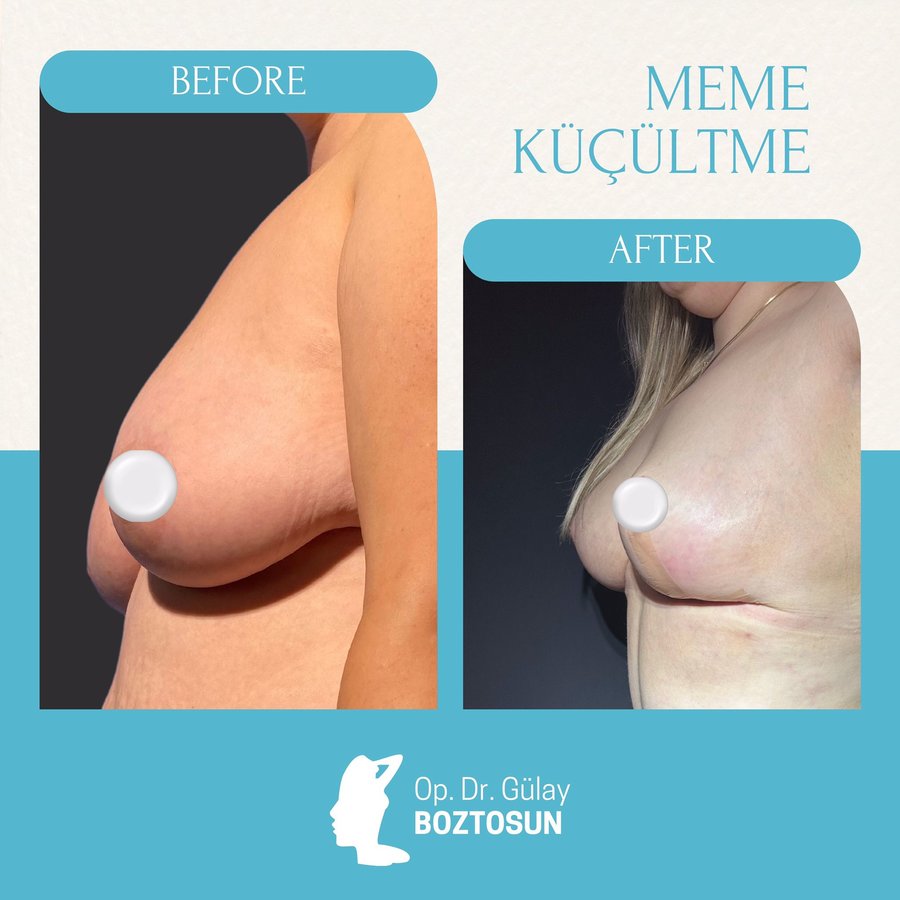 Op. Dr. Gülay Boztosun - Op. Dr. Gülay Boztosun