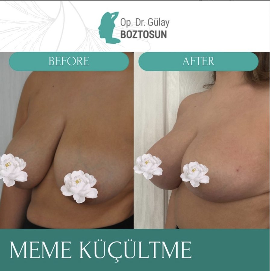 Op. Dr. Gülay Boztosun - Op. Dr. Gülay Boztosun