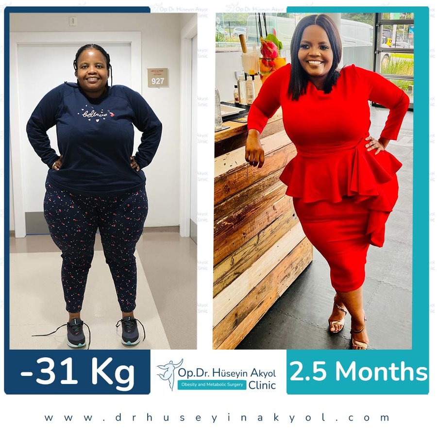 Op. Dr. Hüseyin Akyol Clinic - Op. Dr. Hüseyin Akyol Clinic