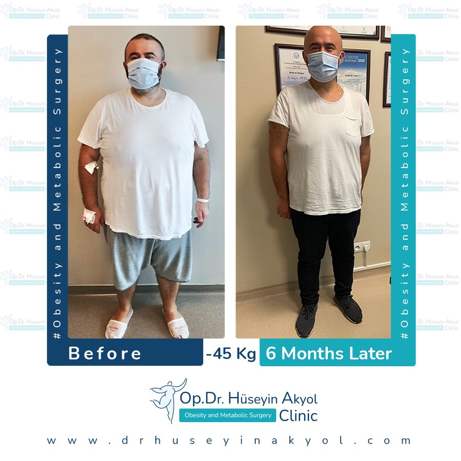 Op. Dr. Hüseyin Akyol Clinic - Op. Dr. Hüseyin Akyol Clinic