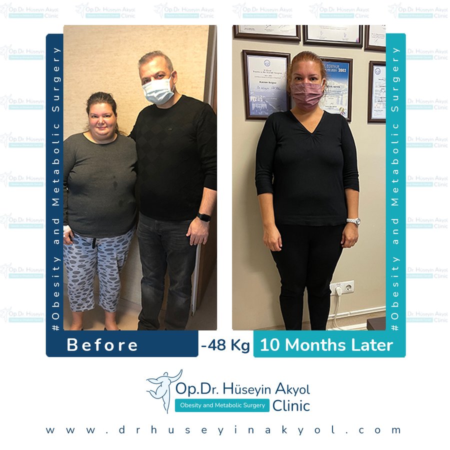 Op. Dr. Hüseyin Akyol Clinic - Op. Dr. Hüseyin Akyol Clinic