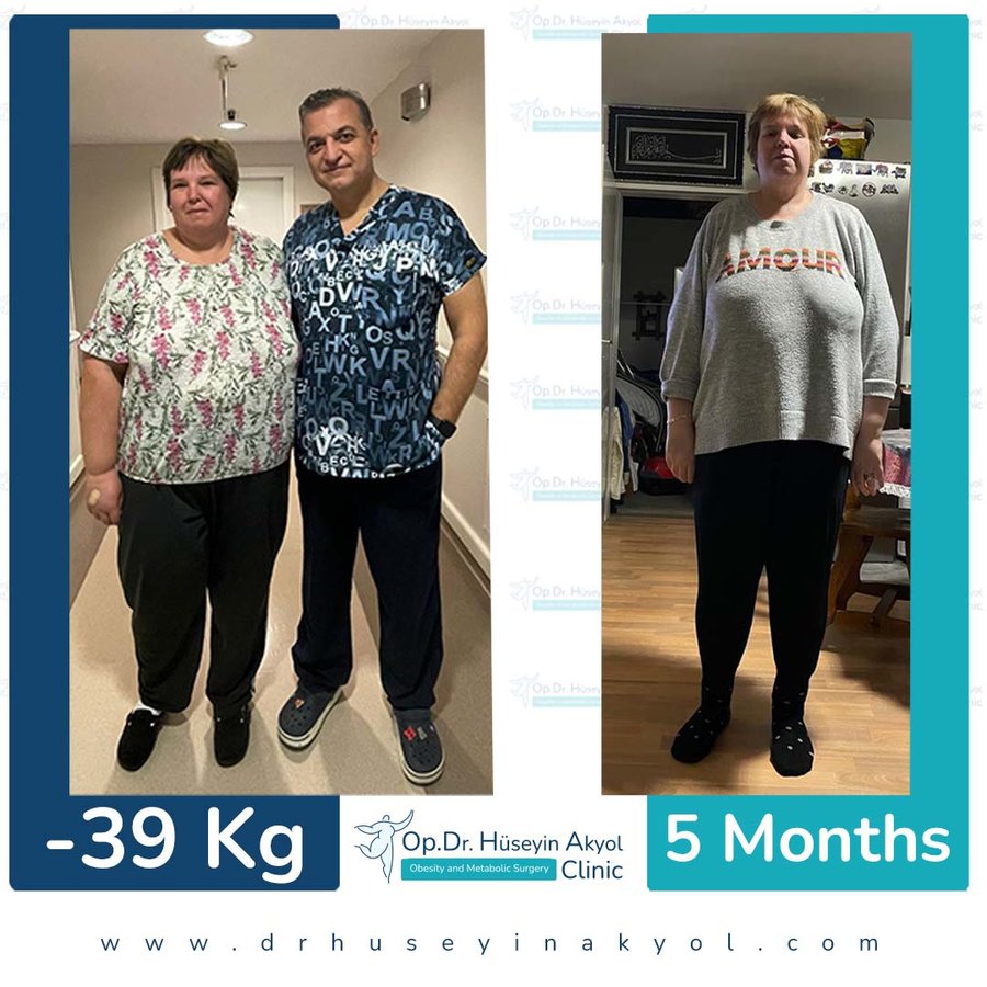 Op. Dr. Hüseyin Akyol Clinic - Op. Dr. Hüseyin Akyol Clinic