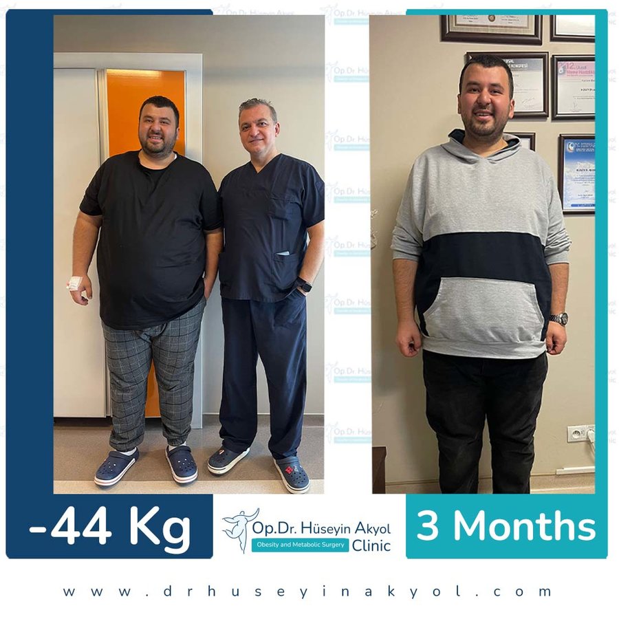 Op. Dr. Hüseyin Akyol Clinic - Op. Dr. Hüseyin Akyol Clinic