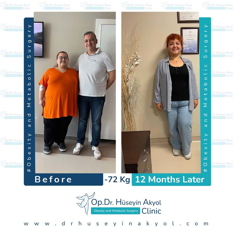 Op. Dr. Hüseyin Akyol Clinic - Op. Dr. Hüseyin Akyol Clinic