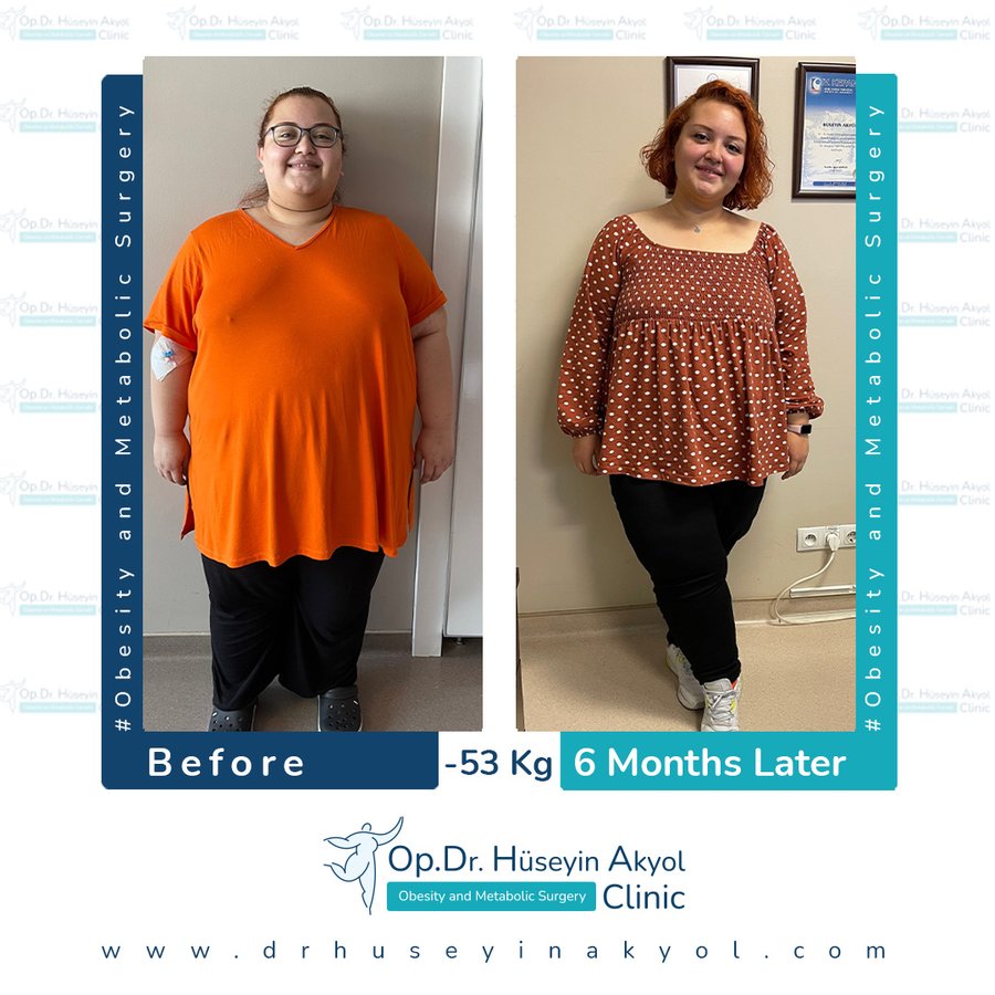 Op. Dr. Hüseyin Akyol Clinic - Op. Dr. Hüseyin Akyol Clinic