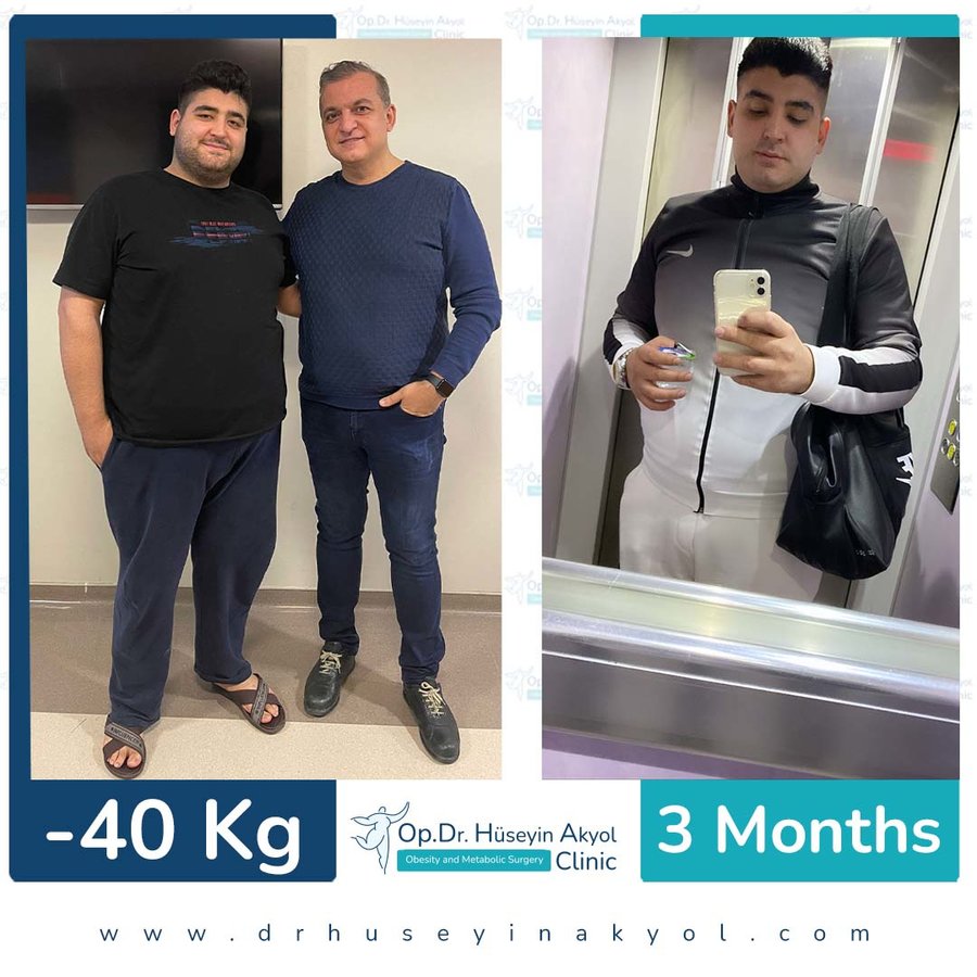 Op. Dr. Hüseyin Akyol Clinic - Op. Dr. Hüseyin Akyol Clinic