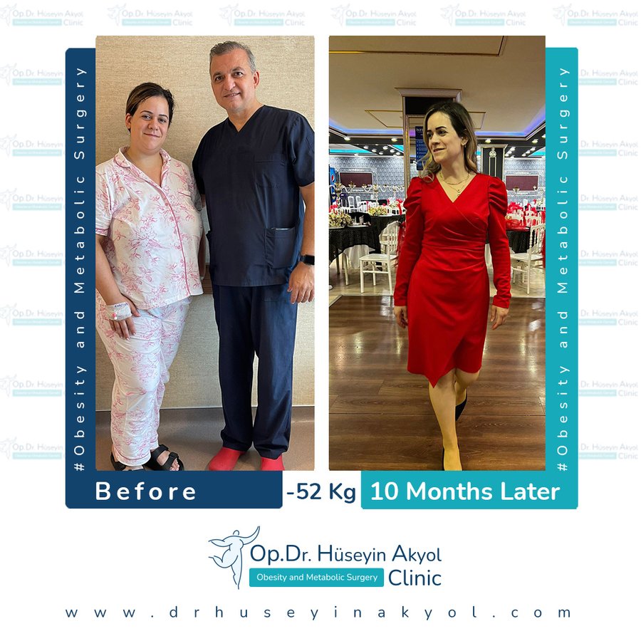 Op. Dr. Hüseyin Akyol Clinic - Op. Dr. Hüseyin Akyol Clinic