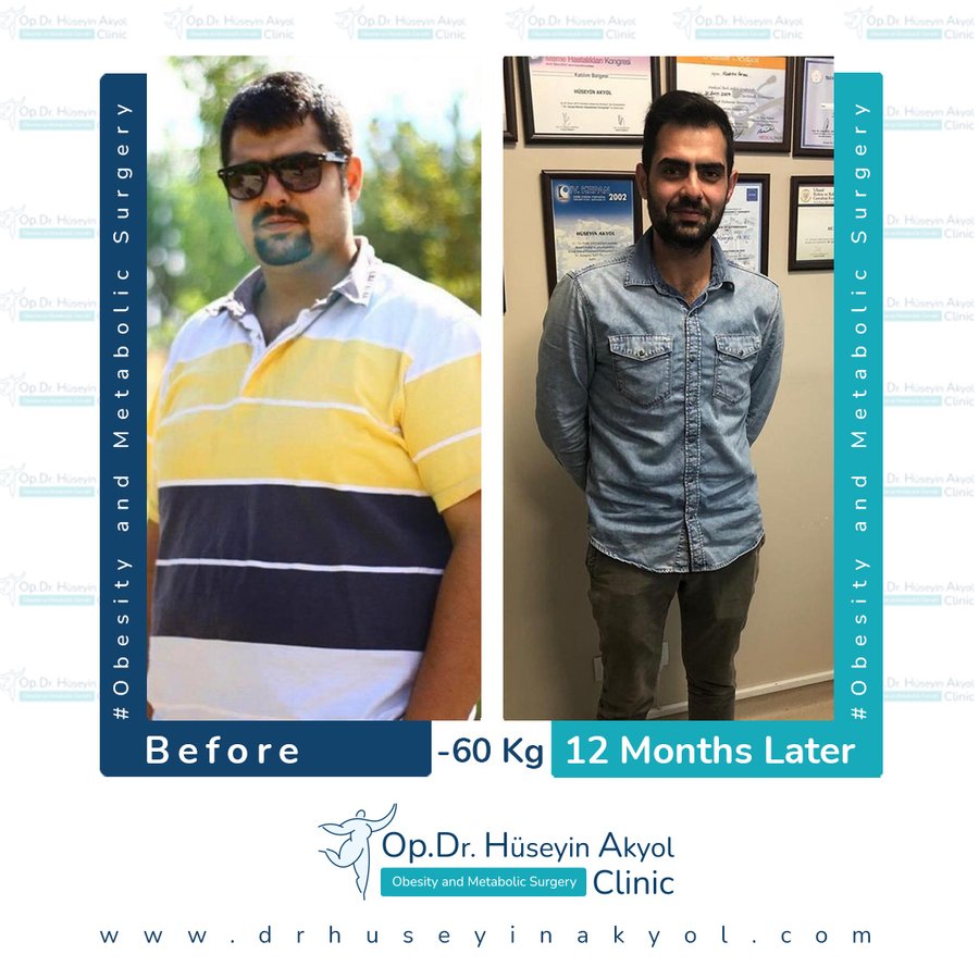 Op. Dr. Hüseyin Akyol Clinic - Op. Dr. Hüseyin Akyol Clinic