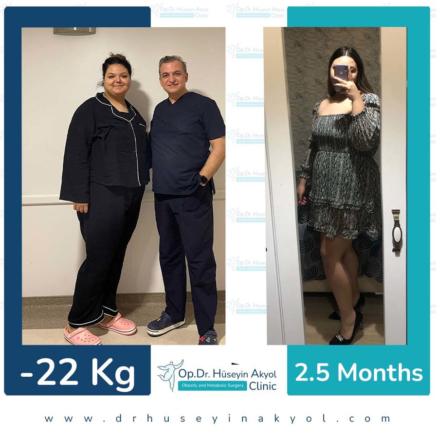 Op. Dr. Hüseyin Akyol Clinic - Op. Dr. Hüseyin Akyol Clinic