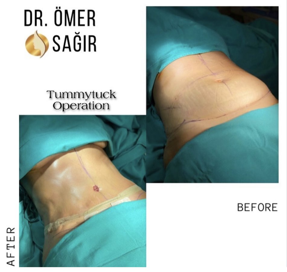 Op. Dr. Ömer Sağır - Op. Dr. Ömer Sağır