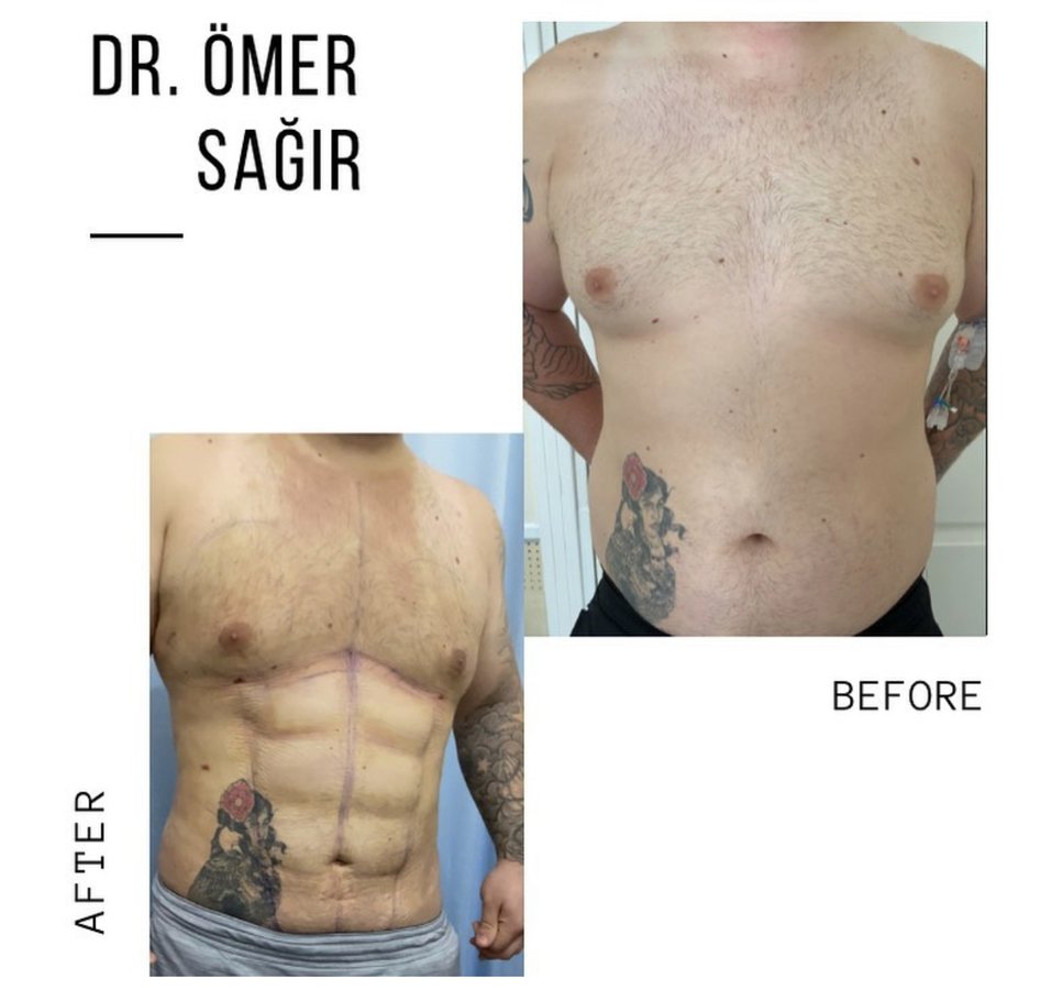 Op. Dr. Ömer Sağır - Op. Dr. Ömer Sağır