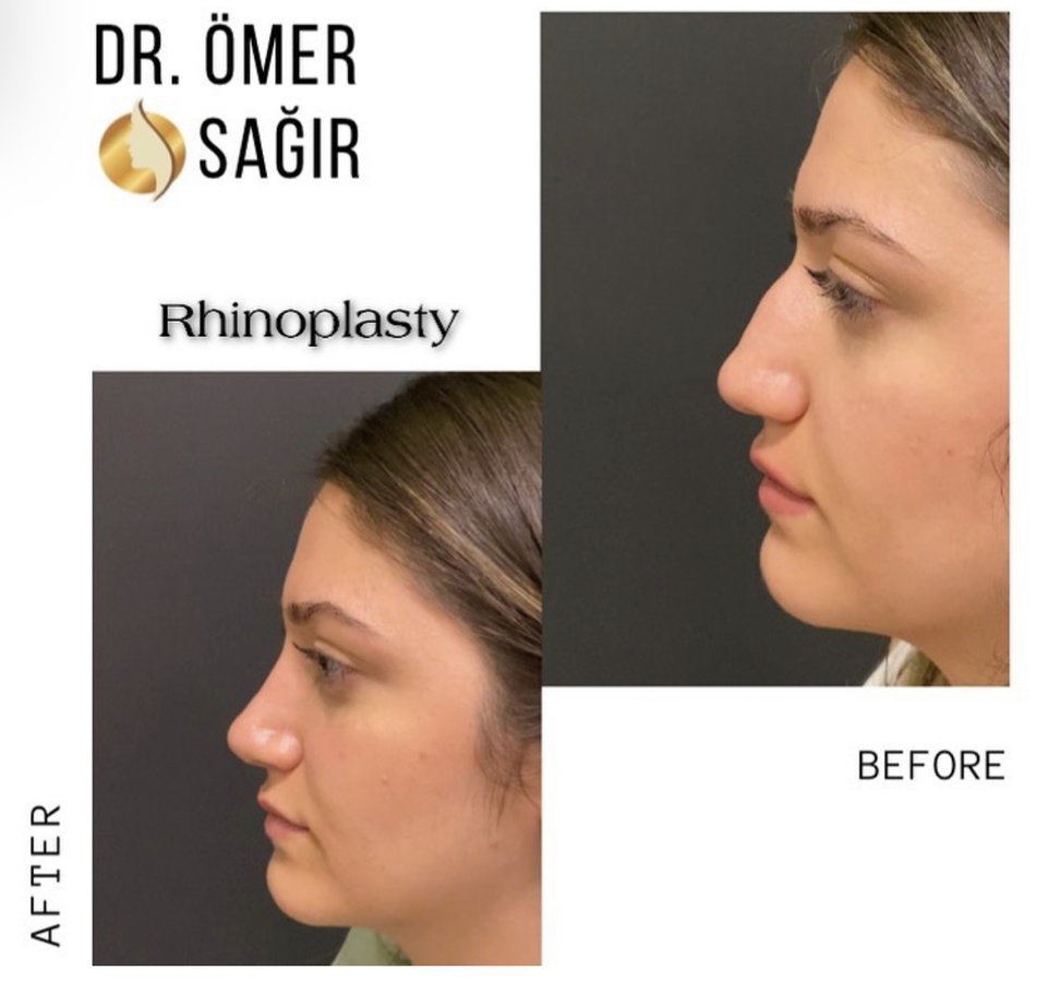 Op. Dr. Ömer Sağır - Op. Dr. Ömer Sağır