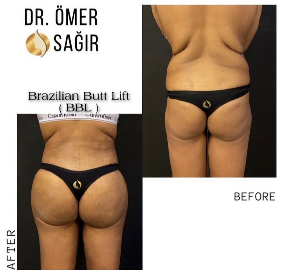 Op. Dr. Ömer Sağır - Op. Dr. Ömer Sağır