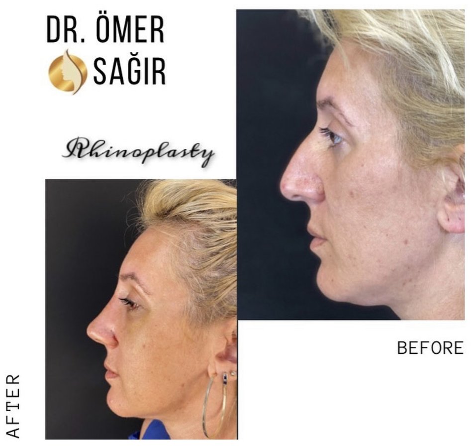 Op. Dr. Ömer Sağır - Op. Dr. Ömer Sağır