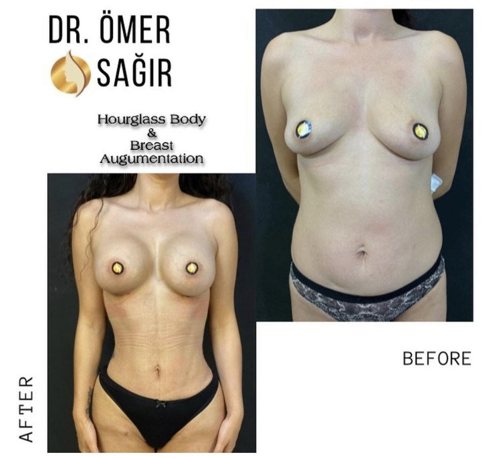 Op. Dr. Ömer Sağır - Op. Dr. Ömer Sağır