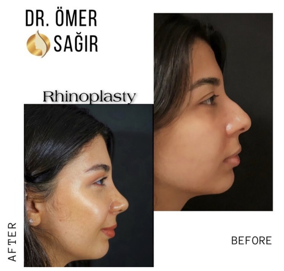 Op. Dr. Ömer Sağır - Op. Dr. Ömer Sağır