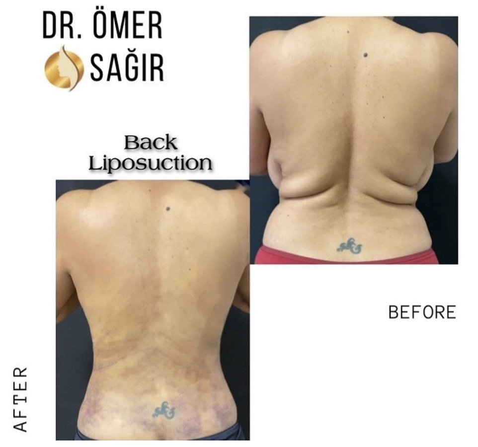 Op. Dr. Ömer Sağır - Op. Dr. Ömer Sağır